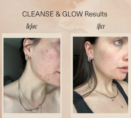 Cleanse & Glow Set by Aloisia Beauty